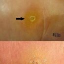 까만콩쌀알 이미지