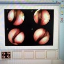 함소아한의원 | 초등 키성장 / 한방 치료 시작 - 함소아 한의원 동백점 후기