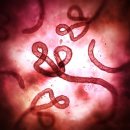 에볼라 출혈열[ebola hemorrhagic fever] 이미지