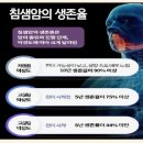 침샘암 진단과 치료 이미지