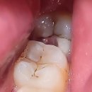 휴플란트치과의원 이미지