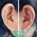 글루타플러스