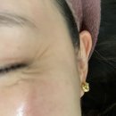 청담글래시피부과의원 이미지