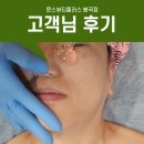 구미 잡티관리 피부샵 추천 문스뷰티플러스 후기