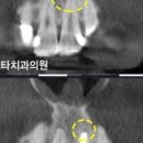 이승훈치과의원 이미지