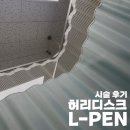 버팀병원 | L-PEN 신경성형술 후기 버팀병원 수원 망포역 정형외과 허리디스크 허리통증