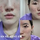 유화약국 | 뷰블2탄(클렌징&amp;스팟)