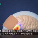 [공유] 나날이 발전하는 ‘뇌 조종(임플란트)’ 기술 이미지