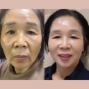 인셀덤순수