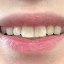 넬시스템 | 미백치약 화이트닝 치약 고민이라면, 덴티넬 고체치약 대용량 180정 후기