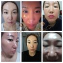 송탄인셀덤