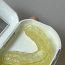 조인트치과의원 | 대구턱관절전문 조인트 치과 턱 교정기로 턱 통증 및 소리 교정한 찐 후기(9년째)