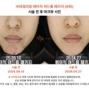 옥정피부과 추천, 내돈내산 후기 믿을 수 있을까?