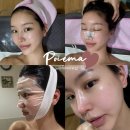 수원 영통 웨딩관리 포이에마피부샵 물방울 리프팅 ,작은얼굴 관리 후기