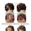 바이오 테라피 100 이미지