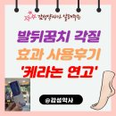 우정약국 | 각질 두꺼워진 발뒤꿈치, 케라논연고 후기·사용법·판매약국 총정리 (feat. 부산 북구 우정약국)