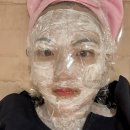 평촌자연과한의원 | 안양 편평사마귀 쥐젖 제거 후기 :: 내돈내산 관리방법 가격 재생크림