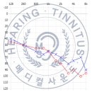 제일보청기 이미지