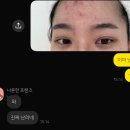 영남부분정비 | [청주 에스테틱 스킨플래닝] 유앤데이 웨딩·신부 피부 관리받고 깐복숭아 된 후기