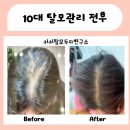페스트케어 | 목동10대 청소년 탈모케어 후기, 조기 관리가 중요합니다.