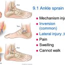 발목 염좌(Ankle Sprains) Ⅱ 이미지