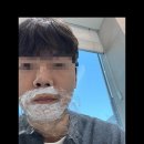 부산 콧볼축소 수술 내돈내산 후기 이미지