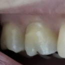 서울누가치과의원 이미지