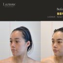 라즈뮤에스테틱 | 병점 에스테틱 병점역 웨딩 신부관리 윤곽관리 라즈뮤에스테틱 후기