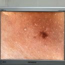 필치과병원 | 교대피부과 얼굴콜라겐주사 아텔로필 가격 통증 효과 후기❤️