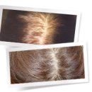 바로스탑한의원 이미지