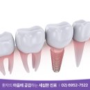 서울오라클치과의원 이미지