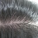 더 미 헤어(The美Hair) | 여성 탈모, 셋째 출산 후 탈모약 부작용과 M자 모발이식 퇴화까지 극복한 부산 원탈모클리닉 리얼 후기