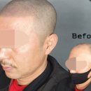 일러스라인 이미지