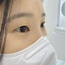 세븐일레븐 강릉교항점 | 강릉속눈썹펌 에르미엘뷰티 임산부도 가능한 속쌍커플 변화 후기