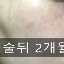 정영철피부과의원 네이버블로그