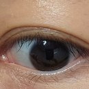 해맑은피부과의원 이미지