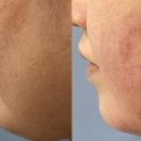 힐리브의원 이미지