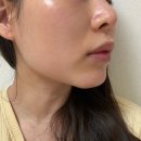 대한에너지 | 💍 잠실에스테틱 오늘 뷰티 웨딩관리 후기｜에너지테라피 풀페이스 리프팅 케어