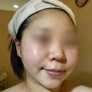 덕명빌딩 | 구미문성피부관리 제이에스테틱 골드다이아화이트토닝 솔직후기