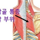 세종해밀한의원 네이버블로그