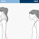 라인업 체형교정 이미지
