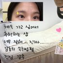 누니래쉬 이미지
