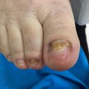 푸스케어 남포점 글림네일 이미지