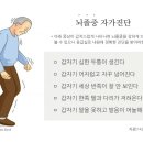 뇌졸중 이미지
