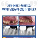 삼성플란트치과의원 이미지