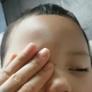 까만안경(동부) | 아이가 눈뜨고 잠. 의정부 서울신세계안과에서 눈뜨고 자는 아이 정밀검사 하러갔어요.
