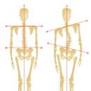 중앙보조기 이미지