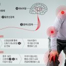 잠실의료기기 이미지