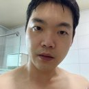 스윗대디 | 목동레이저제모 젠틀맥스 프로플러스 1회차 후기 효과가 확실한 남자 턱 제모