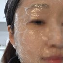 보아한의원 | 의정부 노원 노원기미레이저 한의원 기미 제거 치료 레이저 약침 통증 애브넘 잡티 후기